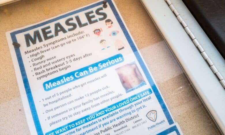 Michigan reports first confirmed the measles outbreak since 2019