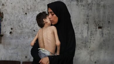 'They are losing hope': what doctors, humanitarian workers are seeing in Gaza in the midst of the hunger crisis
