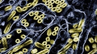 Suspected human bird flu case may be first in US in nine months