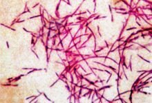 PHOTO: In this file photograph you can see the Legionnaires' disease bacteria.