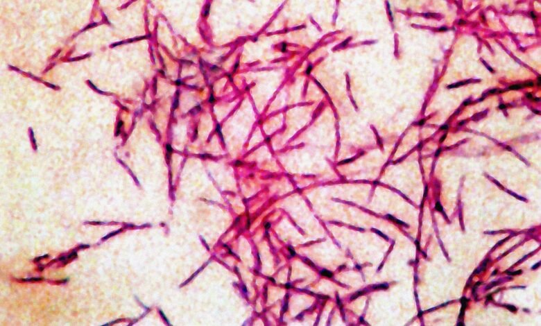 PHOTO: In this file photograph you can see the Legionnaires' disease bacteria.