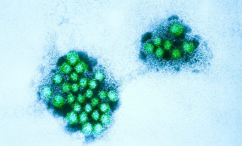 Norovirus cases rise in Los Angeles County: health officials